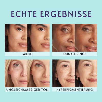 Veloura™ – All-in-One-Hautperfektionierungscreme