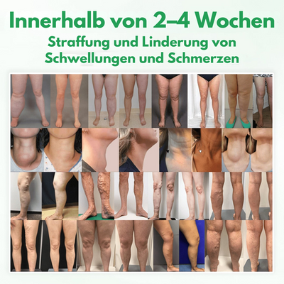 Lymphora™ – Natürliche Linderung von Schwellungen
