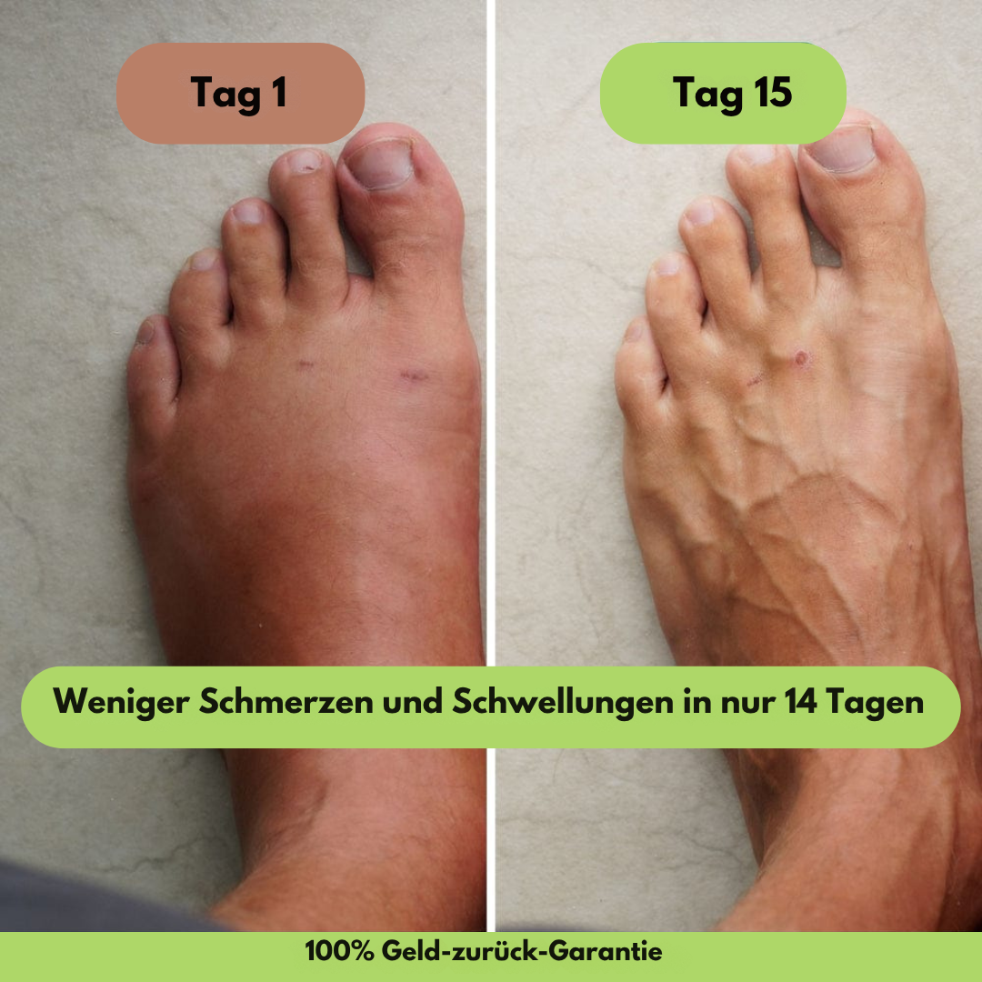 Relief Wrap™ – Elektronisches Schmerztherapieband