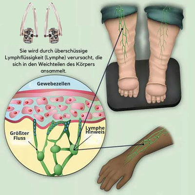 Lymphi™ - Ohrringe mit lymphatischer Magnettherapie