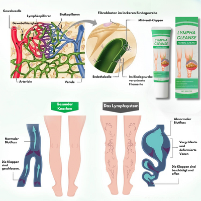 Lymphora™ – Natürliche Linderung von Schwellungen