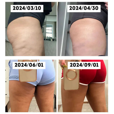 Sculptelle™ – Fortschrittliches 4-in-1 Anti-Cellulite Massagegerät