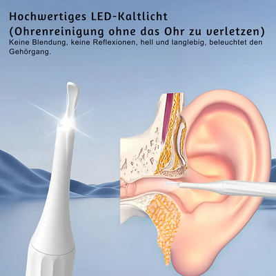 ClearEar™ – HD Smart Ohrenschmalz-Entfernungsset