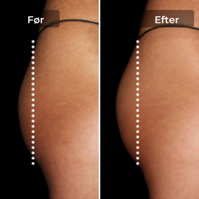 CoreLift™ – EMS-Shorts zum Formen und Straffen