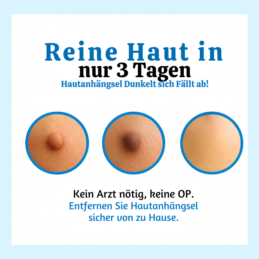 DermaLoop™ – Schmerzfreier Hautanhängsel-Entferner