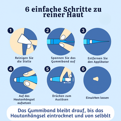 DermaLoop™ – Schmerzfreier Hautanhängsel-Entferner