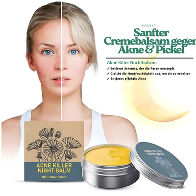 PuriZen™ – Sanfter Cremebalsam gegen Akne & Pickel