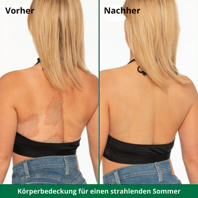 SkinLuxe™ – Sofortiger Körperabdeckungs-Perfektionierer