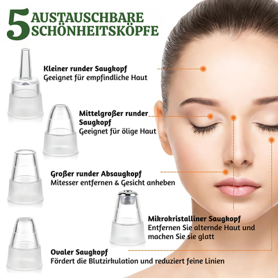 SkinVac™ – Fortschrittliches Porenreinigungsgerät