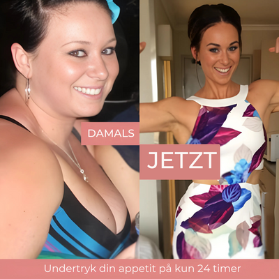 SlimPatch™ – Müheloses Natürliches Fettverbrennungspflaster